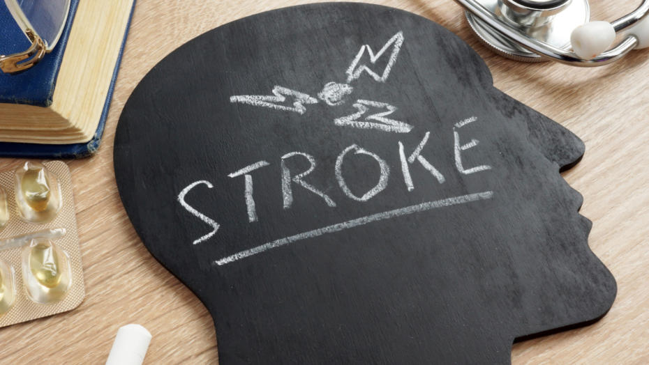 Gettyimages 1088968180 Stroke Gettyimages 1088968180 Stroke