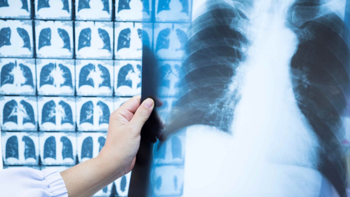 Doctor holding x ray of chest