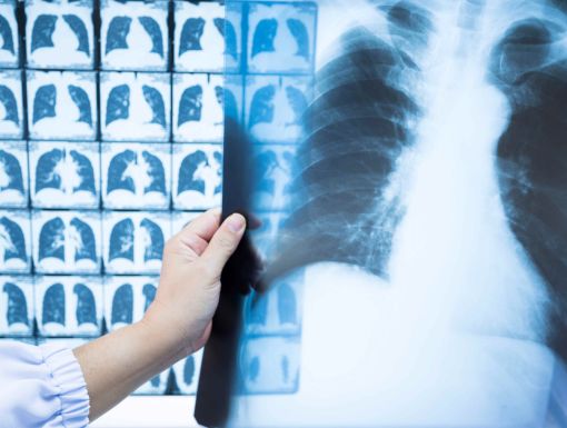 Doctor holding x ray of chest