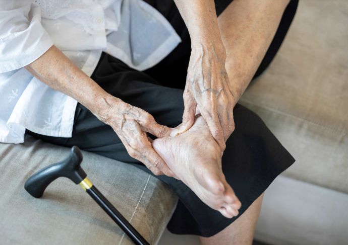 Woman with tendonitis gripping foot