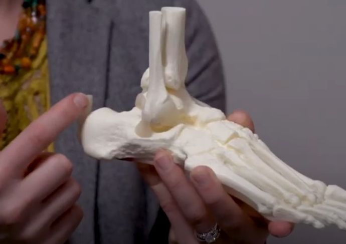 Galli Achilles Tendinitis