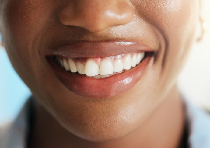 Close up of a woman's smile