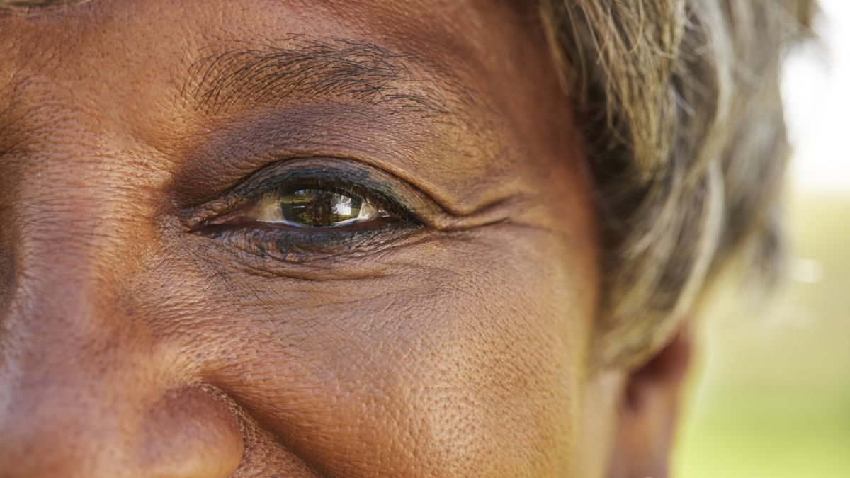 Macular degeneration eyes woman
