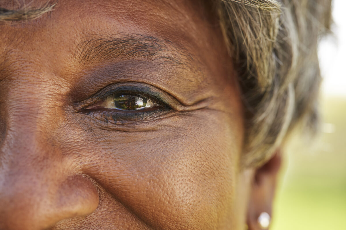 Macular degeneration eyes woman