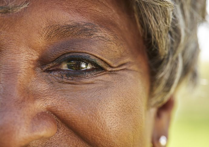 Macular degeneration eyes woman