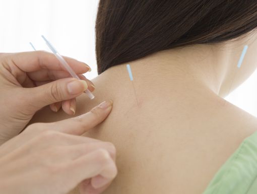 Acupuncture upperback