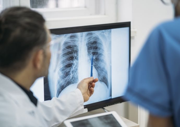 What is pulmonary fibrosis