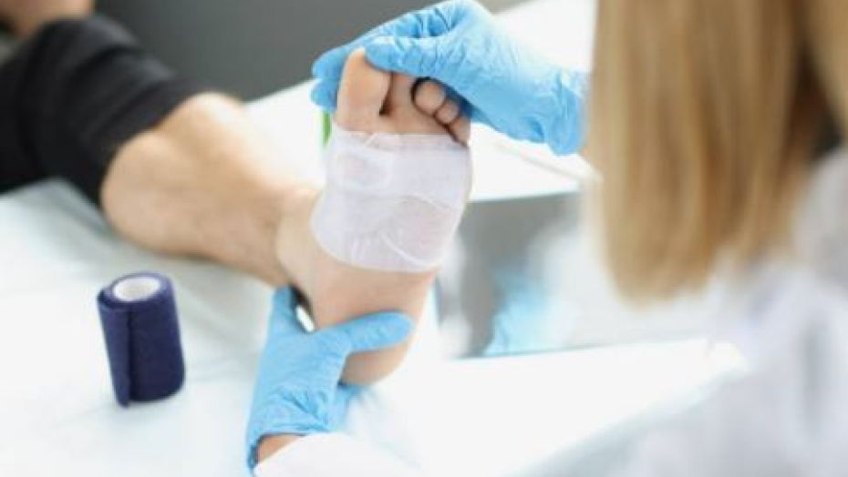 Patient with foot wound