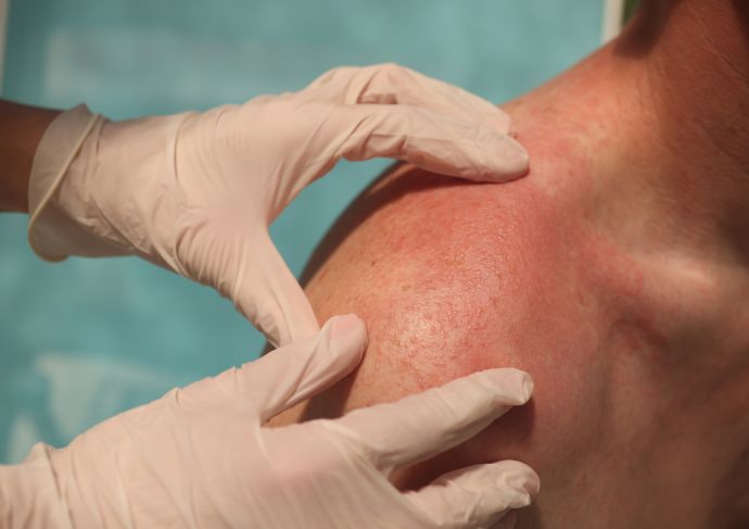 Patient with back rash