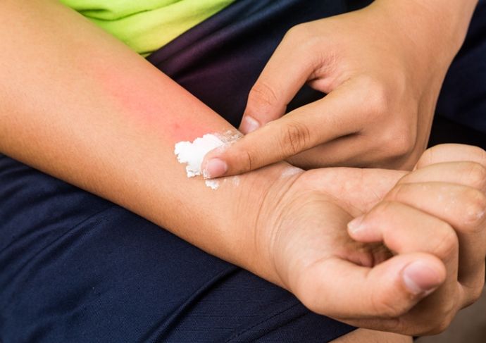 Thinkstockphotos 486417016 Baking Soda Being Used To Relieve Itching