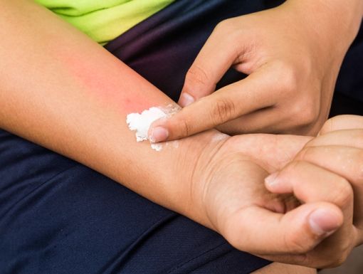 Thinkstockphotos 486417016 Baking Soda Being Used To Relieve Itching