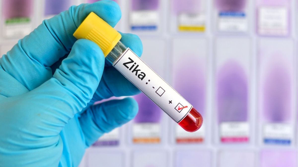 Thinkstockphotos 506042034 Zika Virus Positive
