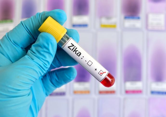 Thinkstockphotos 506042034 Zika Virus Positive