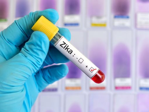 Thinkstockphotos 506042034 Zika Virus Positive