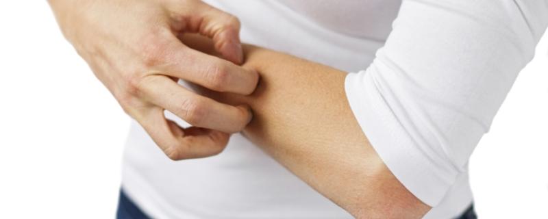 How To Get Rid Of A Mosquito Bite Ochsner Health