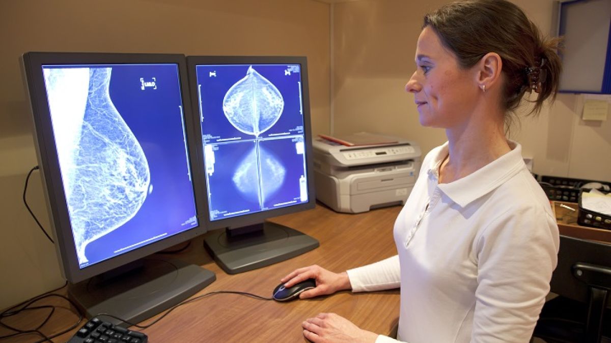 154216755 Breast Cancer Tech Image