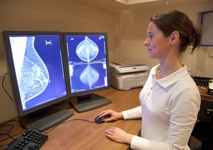 154216755 Breast Cancer Tech Image