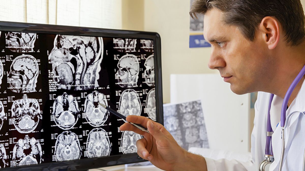 187489411 Doctor Examining Mri Scan Of The Brain