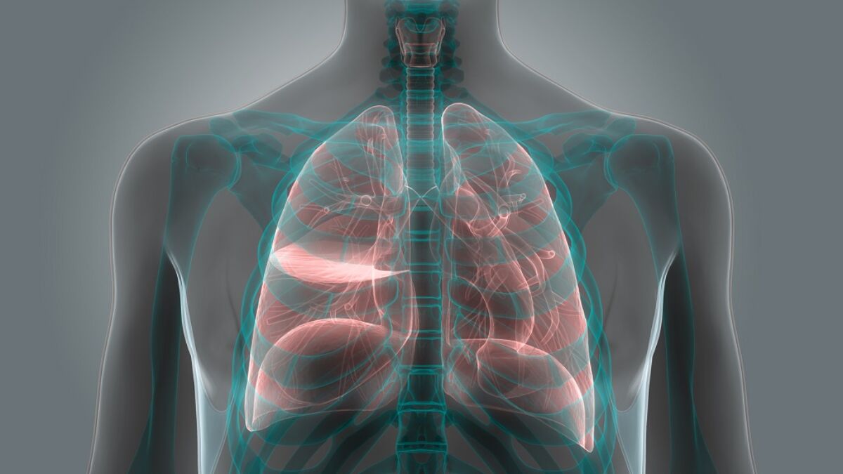 chest X-ray of lungs
