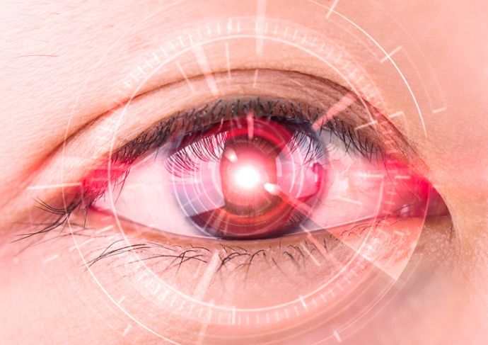 Eyelaserthinkstockphotos 513890426