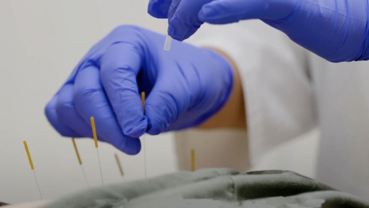 Acupuncture Education