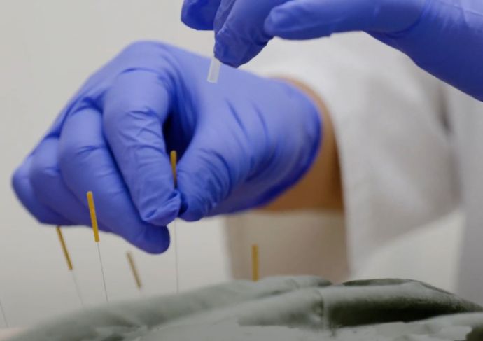 Acupuncture Education