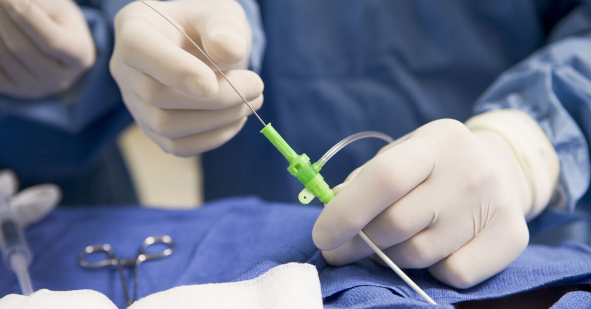 What is a Cath Lab? | Ochsner Health