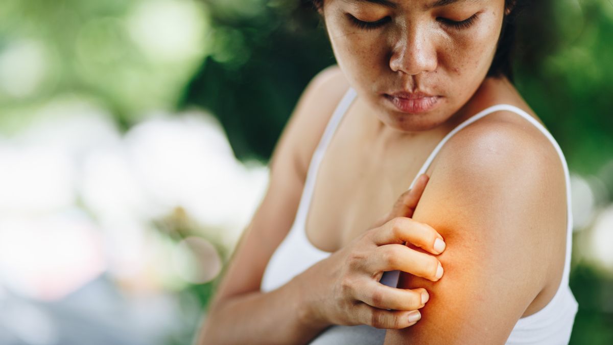 Woman Itching Arm Poison Ivy