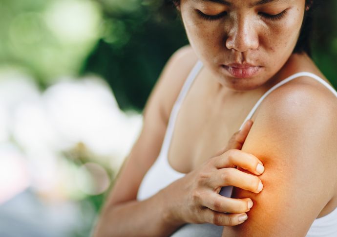 Woman Itching Arm Poison Ivy