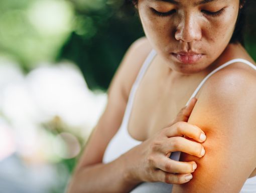 Woman Itching Arm Poison Ivy