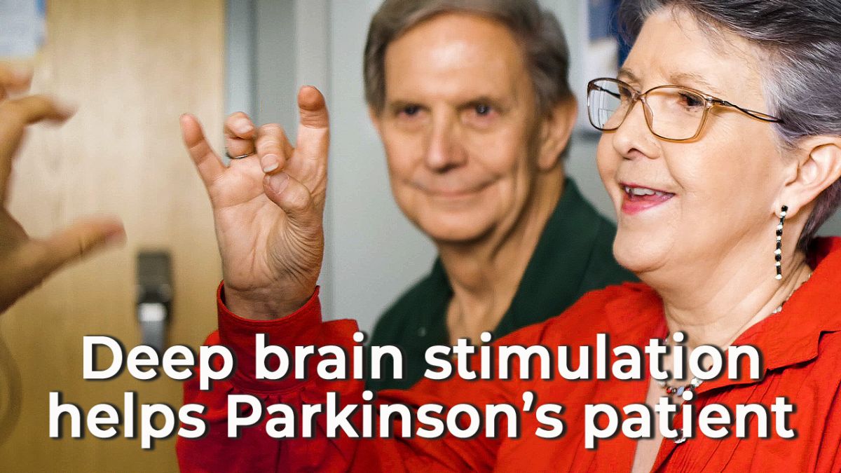 Parkinsons patient after getting deep brain stimulation
