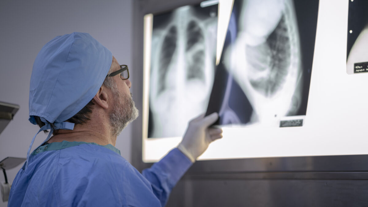 Doctor looking at X-ray of lungs