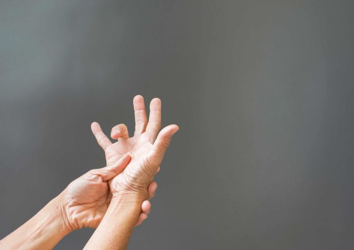 Person with bent finger suffering from Dupuytrens Contracture