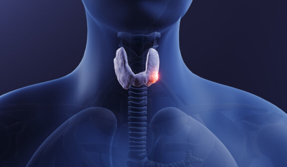 Parathyroid surgery for secondary and tertiary renal hyperparathyroidism