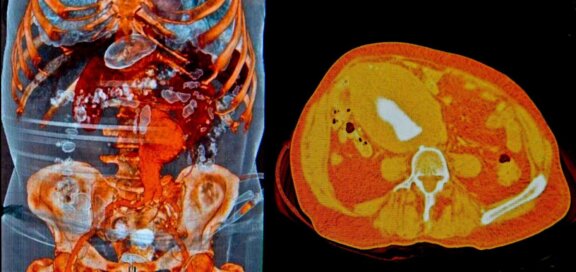 Aortic center MRI photo