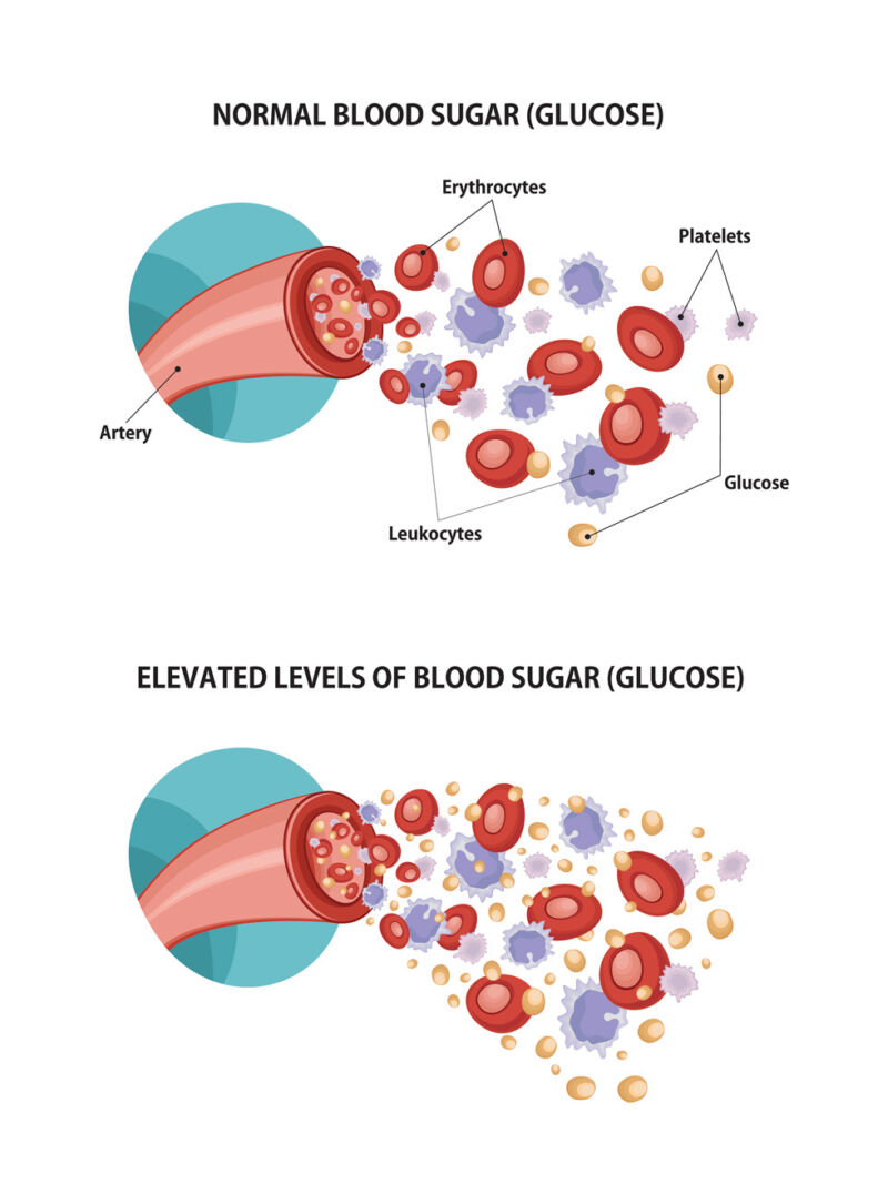 Glucose Web