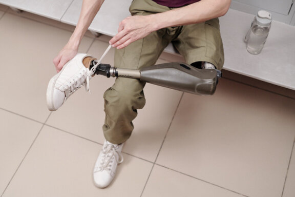 Man tying sneaker with prosthetic leg
